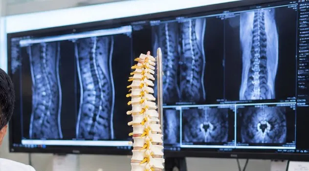 Spine MRI scans